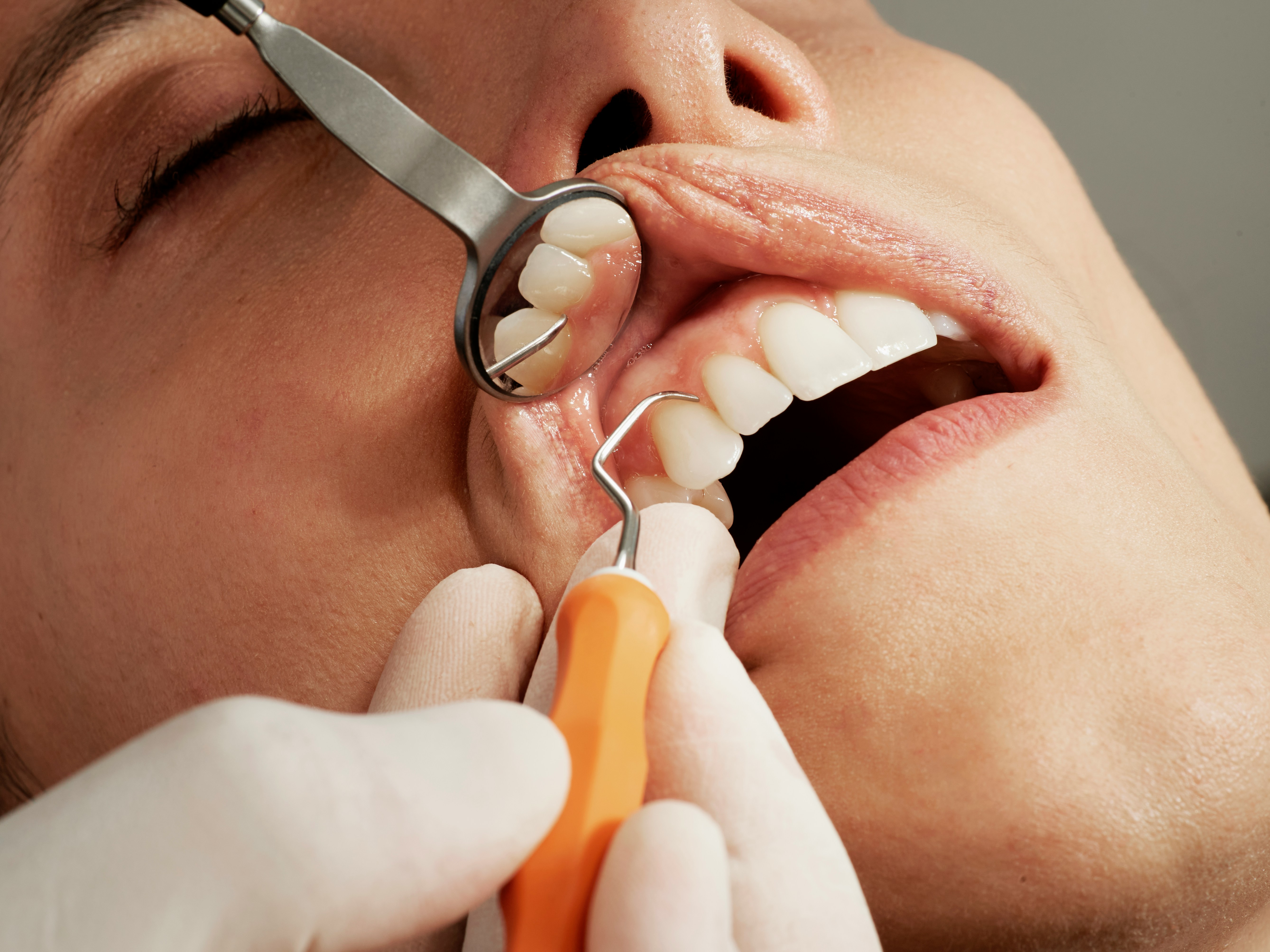 Periodontal assessment at Gartside Street Dental Lounge, Manchester